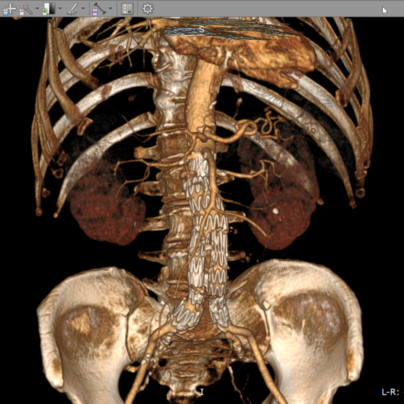 RadiAnt DICOM Viewer 2021,2023,2024 version