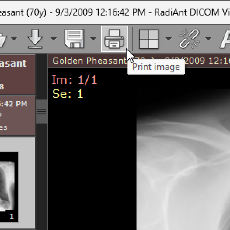 RadiAnt DICOM Viewer 2021,2023,2024 version