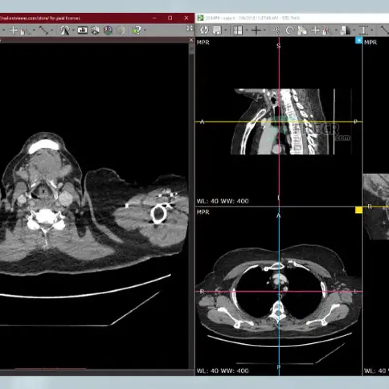 RadiAnt DICOM Viewer 2021,2023,2024 version