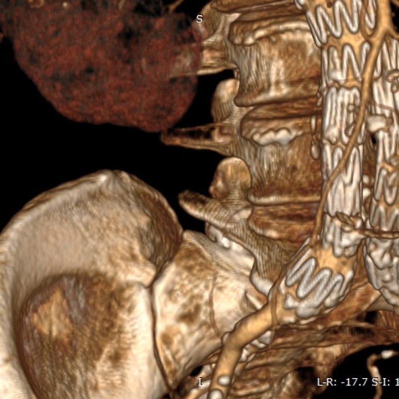 RadiAnt DICOM Viewer 2021,2023,2024 version