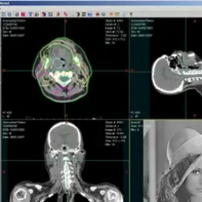 RadiAnt DICOM Viewer 2021,2023,2024 version