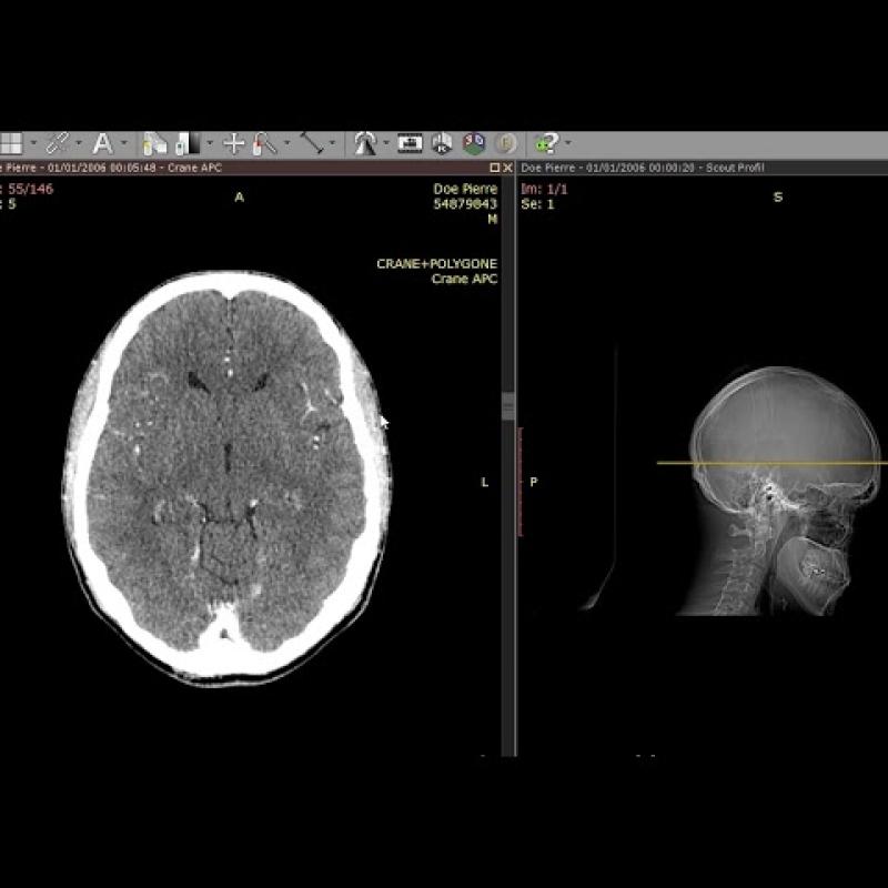 RadiAnt DICOM Viewer 2021,2023,2024 version