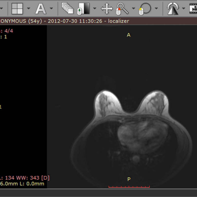 RadiAnt DICOM Viewer 2021,2023,2024 version